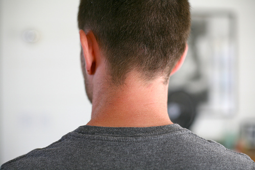 exercícios para tratar o torcicolo