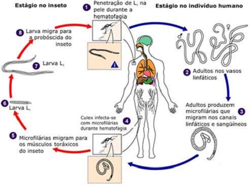 filariose