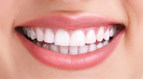 Prevenção e tratamento natural da gengivite Prevenção e tratamento natural da gengivite
