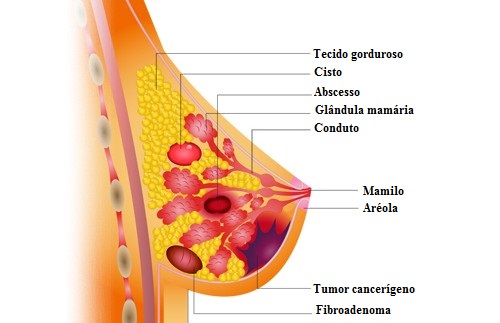 Alimentos que ajudam a prevenir o câncer Alimentos que ajudam a prevenir o câncer