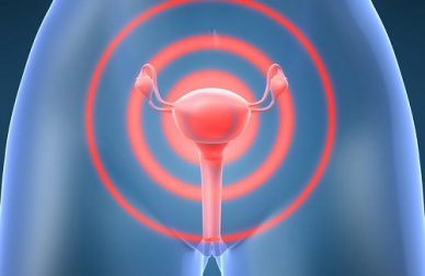 Como reduzir o risco do câncer de útero?