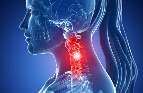 Problemas com as cervicais Problemas com as cervicais
