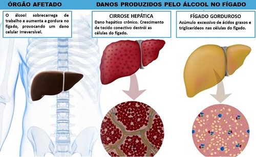 Efeitos do álcool no organismo