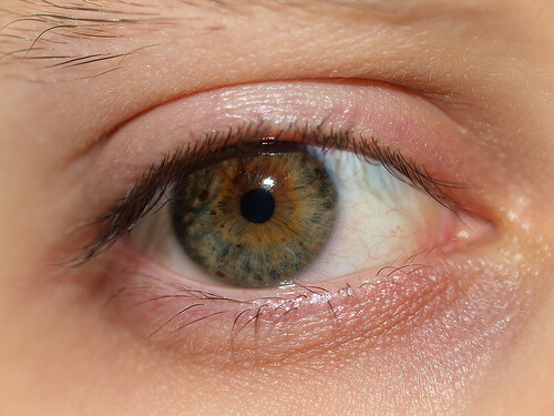 Um dos tratamentos naturais com leite pode ajudar a tratar os olhos inchados