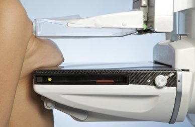 Exames médicos anuais que todas as mulheres devem fazer