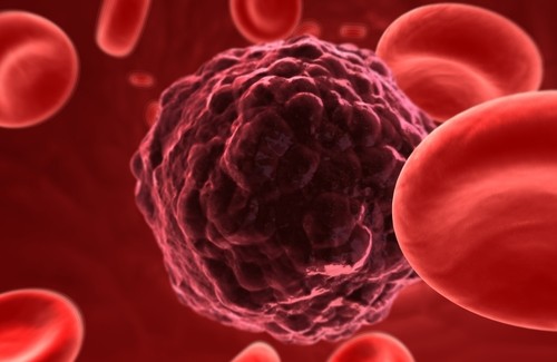 Pesquisas desenvolvem possível método para eliminar células cancerígenas