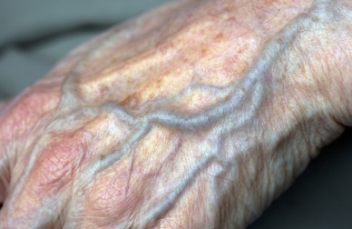 Como melhorar a circulação nas mãos?