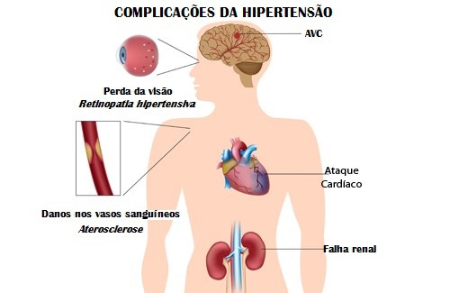 Os melhores alimentos para combater a hipertensão