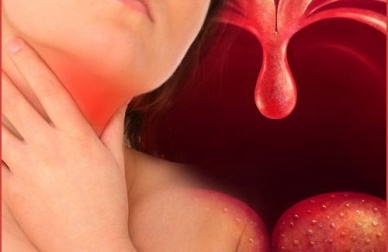 Remédios naturais para ajudar a tratar a faringite