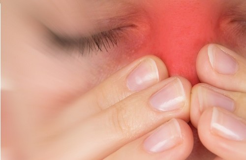 dicas de como tratar a sinusite