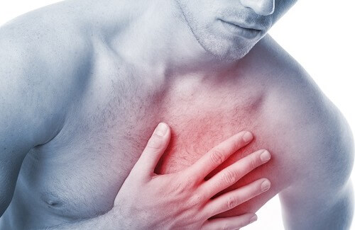 Quais são os sintomas de um infarto?