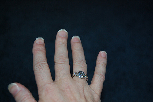 para micose nas unhas
