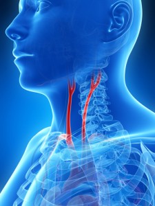 Carotida