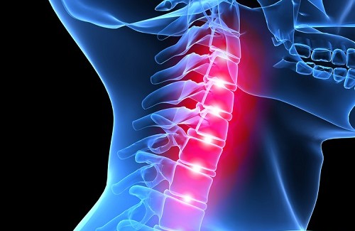 Melhore a postura e alivie a dor cervical Melhore a postura e alivie a dor cervical