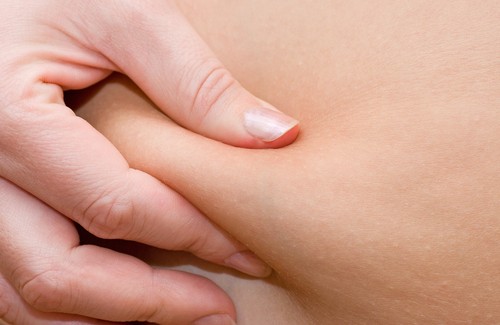 Tratamento para reduzir a gordura nas pernas Tratamento para reduzir a gordura nas pernas