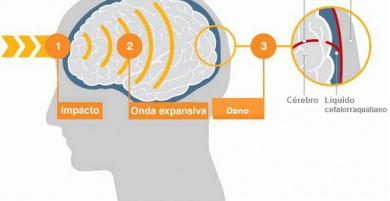 Pancadas leves também podem danificar o cérebro