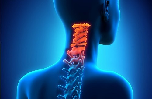 Como prevenir a artrose cervical?