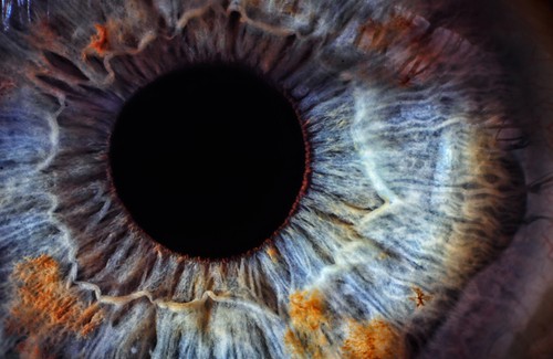 Como conhecer nosso estado de saúde através de nossos olhos Como conhecer nosso estado de saúde através de nossos olhos