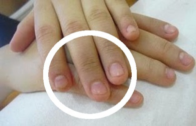 Dicas para não roer as unhas