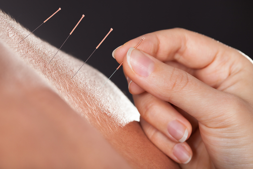 Como aliviar a dor nos joelhos com acupuntura