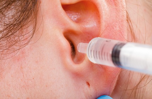 Como limpar os ouvidos corretamente?