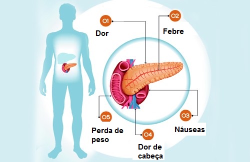 6 sintomas de um problema no pâncreas 6 sintomas de um problema no pâncreas
