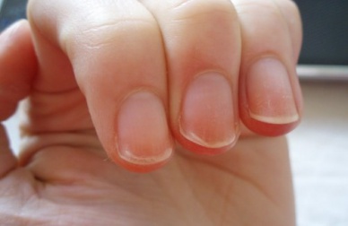 Conhecer a nossa saúde através das unhas