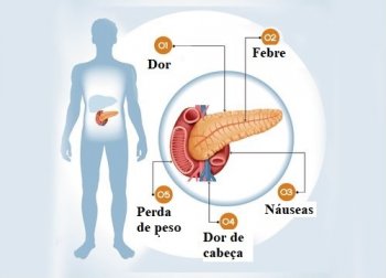 6 sintomas de um problema no pâncreas - Melhor Com Saúde