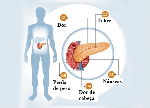 6 sintomas de um problema no pâncreas