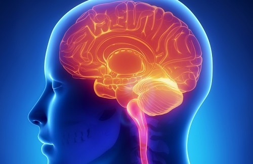 Tipos de derrame cerebral