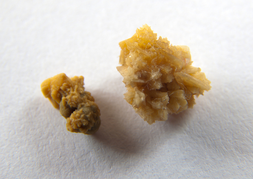 Piedras-en-el-rinon