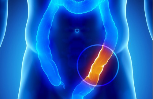 Babosa combate os problemas do cólon