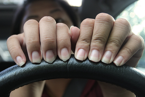 Como tratar a descamação das unhas