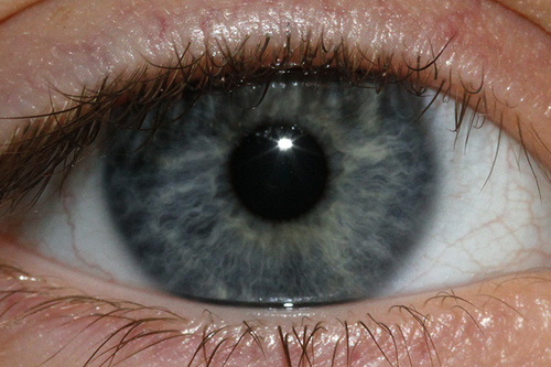 Olho azul analisado pela Iridologia