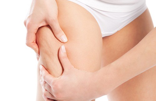 Infusões para combater a celulite Infusões para combater a celulite