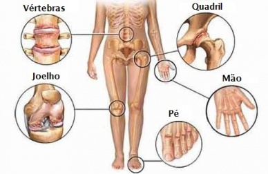 Articulações doloridas? Veja como combater este desconforto