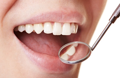 5 removedores de placa bacteriana que funcionam
