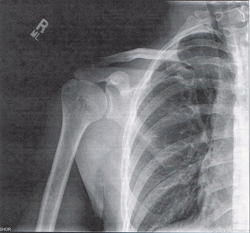 articulacao4