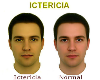 Sinais que sua pele mostra: