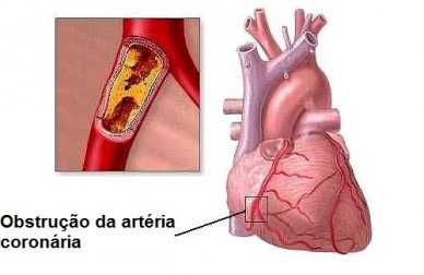 8 hábitos cotidianos que podem causar problemas cardíacos