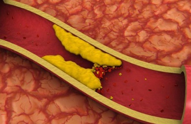 Mais de 10 sucos para reduzir o colesterol