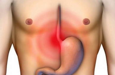 Sintomas de inflamação no esôfago