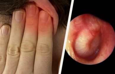 Como tratar as infecções nos ouvidos naturalmente?