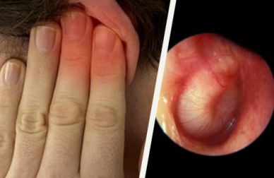 Como tratar as infecções nos ouvidos naturalmente?