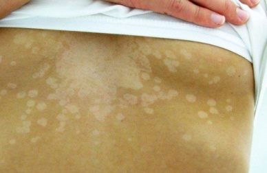 5 sinais que sua pele mostra quando algo não está bem
