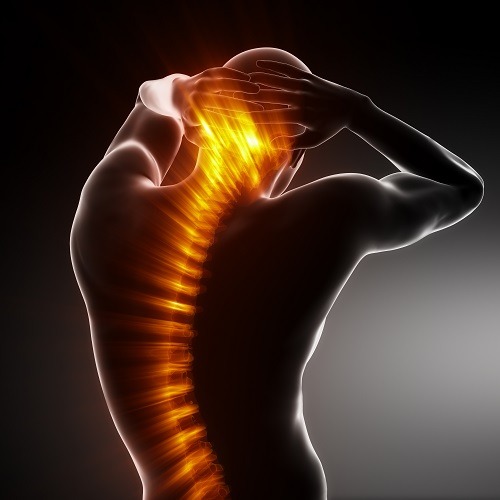 Tratamento de ciática de forma natural