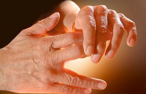Dormentes... por que será que as mãos ficam assim enquanto dormimos?