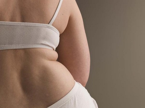 Exercícios para reduzir a gordura das costas