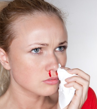 Mulher com sangramento nasal