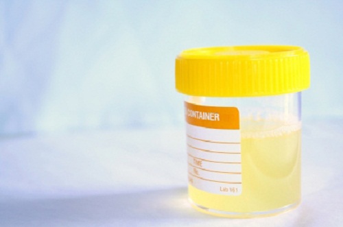 Remédios caseiros para tratar a infecção urinária Remédios caseiros para tratar a infecção urinária